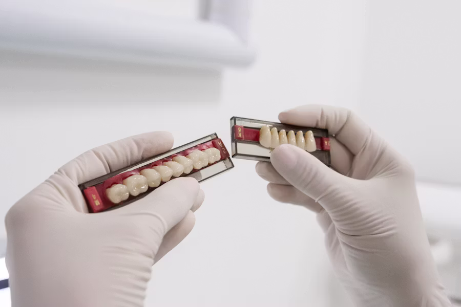 Cura dell'impianto dentale — Studio Dentistico Bordini Quadrelli
