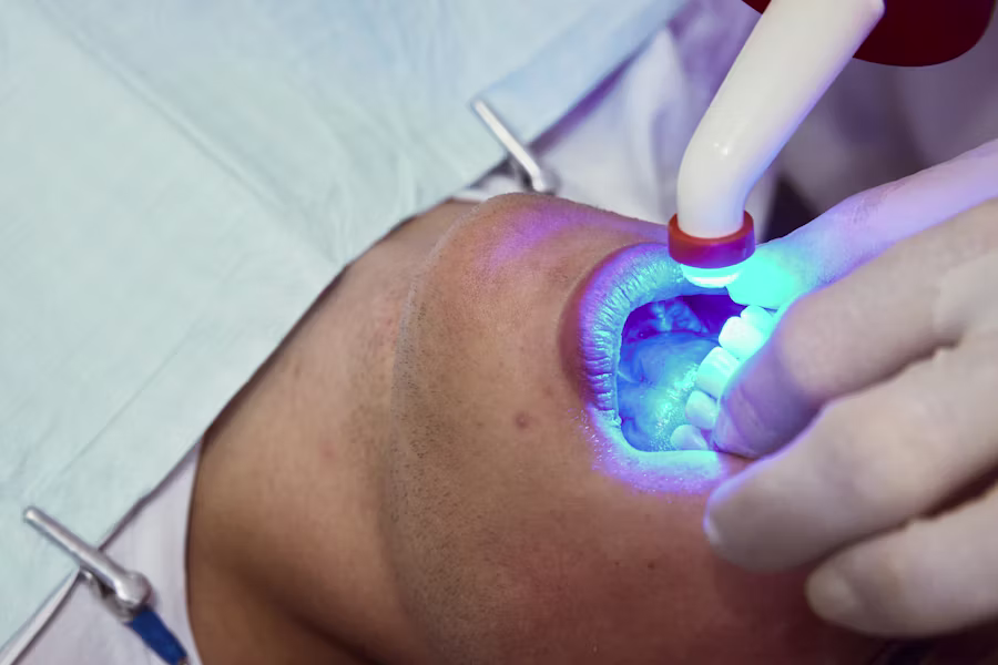 Sbiancamento denti professionale in studio — Studio Dentistico Bordini Quadrelli
